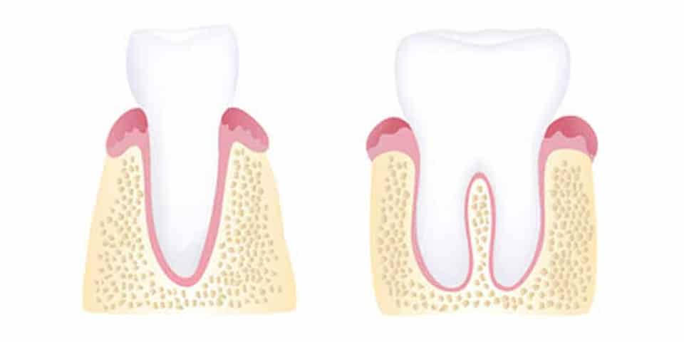 Healthy gums illustration